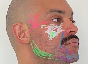 Marcação facial masculina para preenchimento