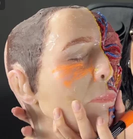 Anatomia aplicada ao preenchimento facial